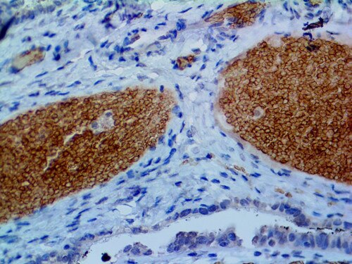 IHC of Spectrin on an FFPE Fallopian Tube Tissue